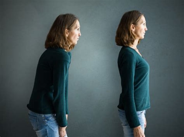 Celebrities With Bad Posture Exposed