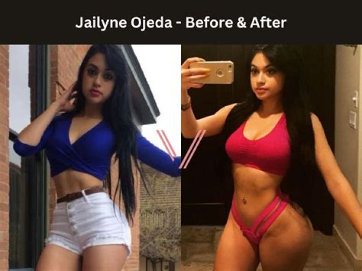 Jailyne Ojeda Ochoa's Surgery Journey Revealed