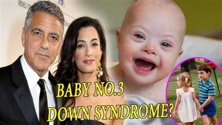Unveiling The Journey Of George Clooney's Kids With Down Syndrome: Discoveries And Insights