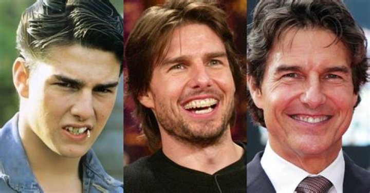 Unveiling The Secrets Of Tom Cruise's Iconic "Top Gun" Teeth: A Journey Of Discovery