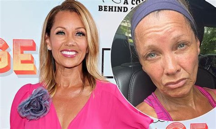 Vanessa Williams' Nose Job Journey